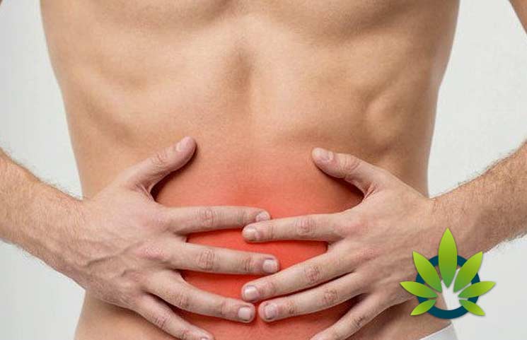 CBD for Irritable Bowel Syndrome