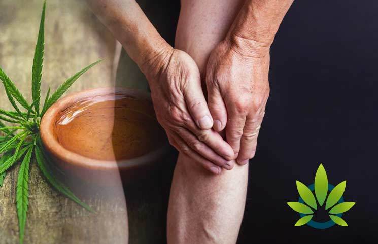 Arthritis Patients Could Benefit From CBD and Medical Cannabis, New CreakyJoints Study Suggests