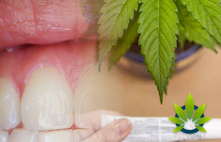 Impression Healthcare Granted Permission to Conduct Phase 2A Trial of CBD for Gum Disease