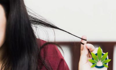 Cannabis Study: It May Reduce Obsessive-Compulsive Body Hair Pulling Disorder, Trichotillomania (TMM)