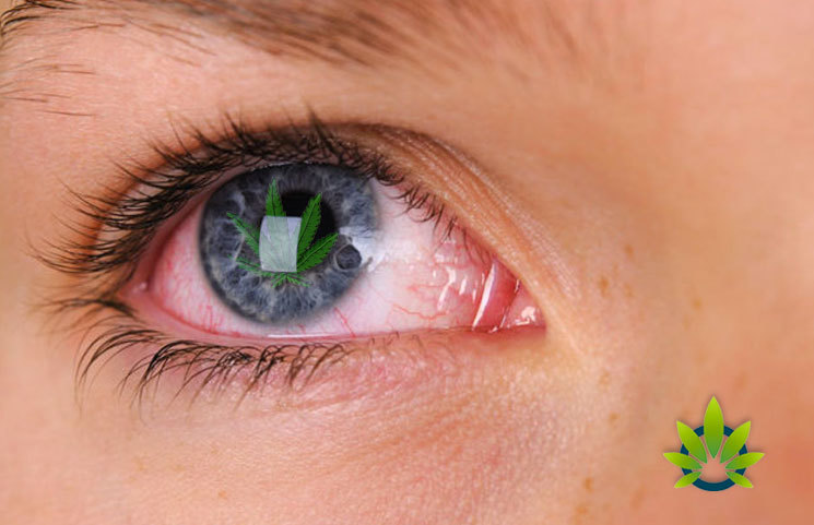 Download CBD Red Eyes: Will CBD Use Cause Red Eyes as a Side Effect ...